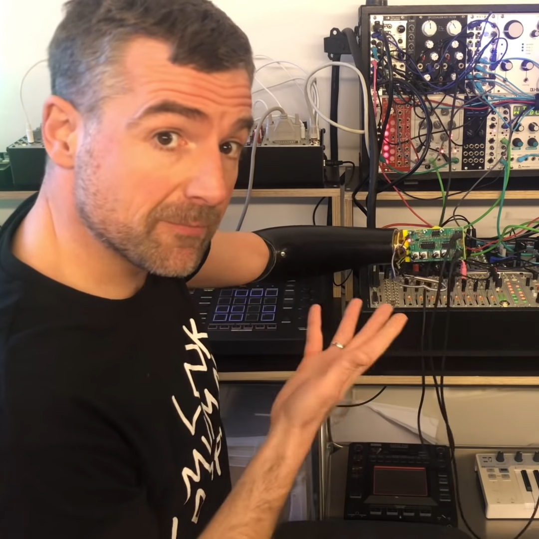 Gedankengesteuerter Synthesizer dank Prothese