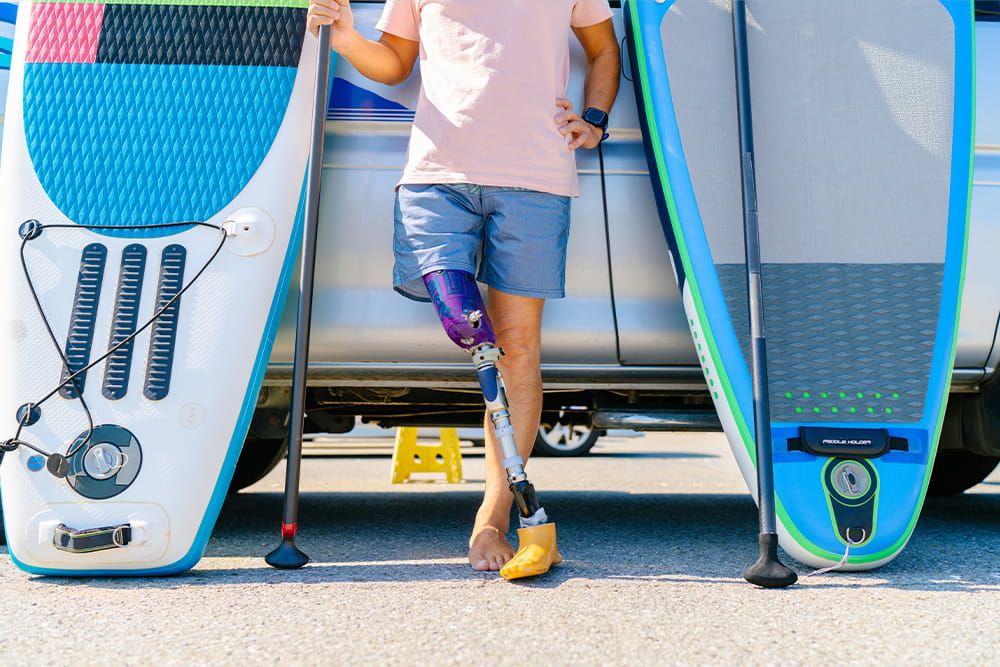 A man with a prosthetic leg stands next to his stand-up paddling boards.