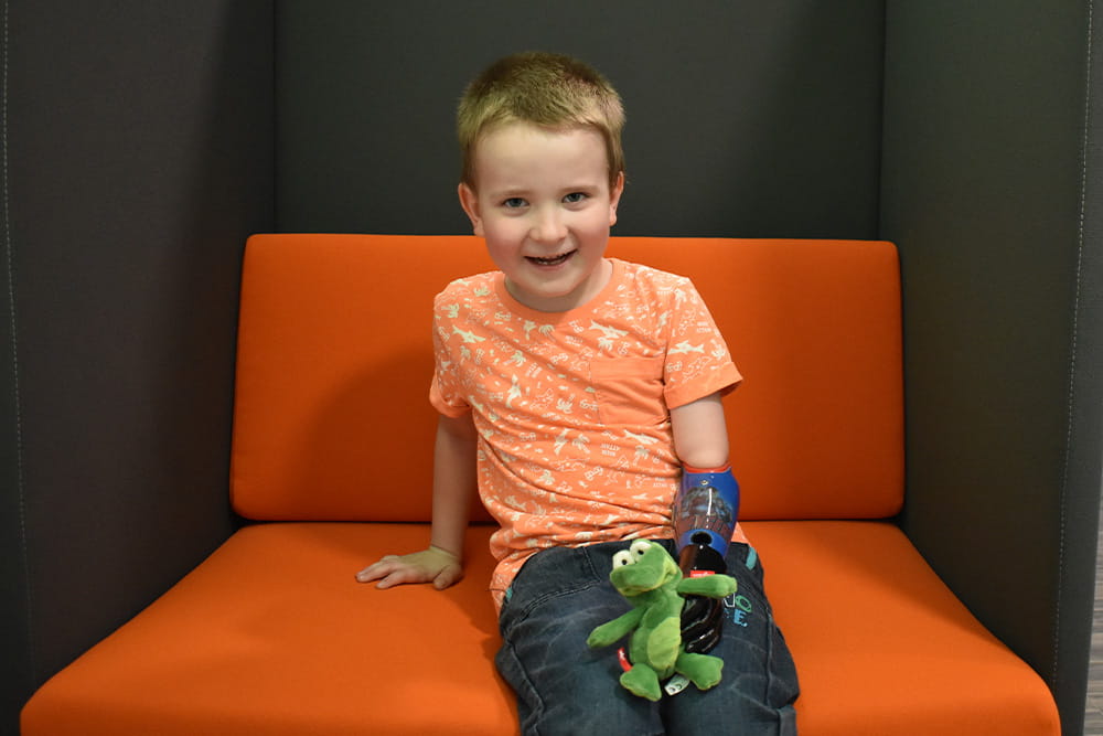 Boy sitting on an orange bench and holding a green Plusch frog in one prosthetic hand.