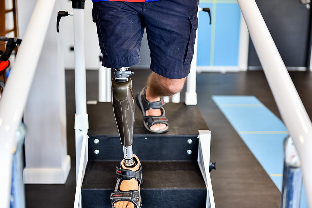 Ein Mann mit Beinprothese geht vorsichtig eine Treppe herunter