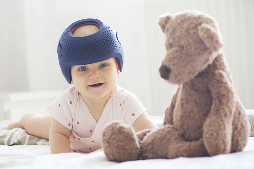A baby with a head orthosis on its head next to a teddy bear