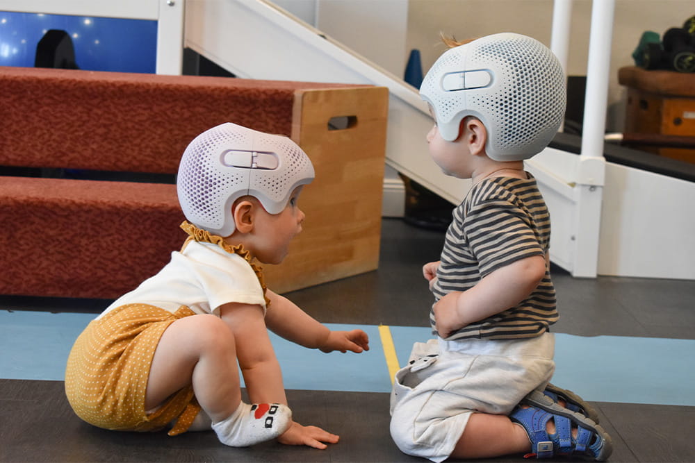 Two toddlers playing together and wearing a Talee head orthosis