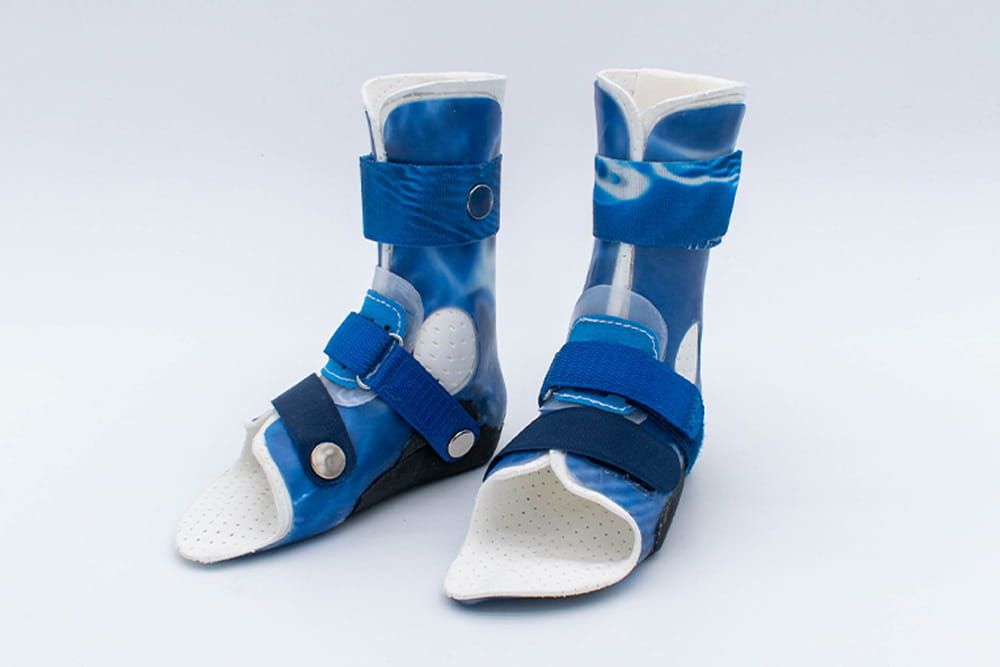 A pair of custom orthoses for the feet in blue with Velcro fasteners.