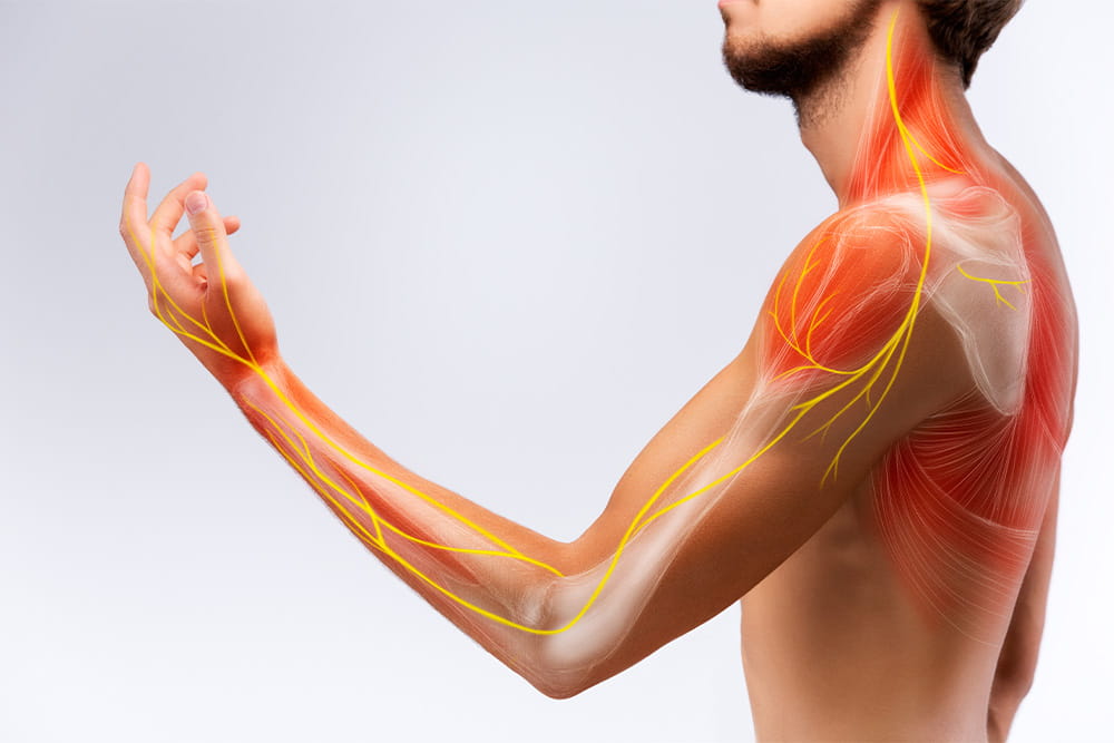 Grafik des Oberkörpers eines Mannes mit schemenhafter Darstellung der Knochen, Muskeln und wichtiger Blutgefäße.