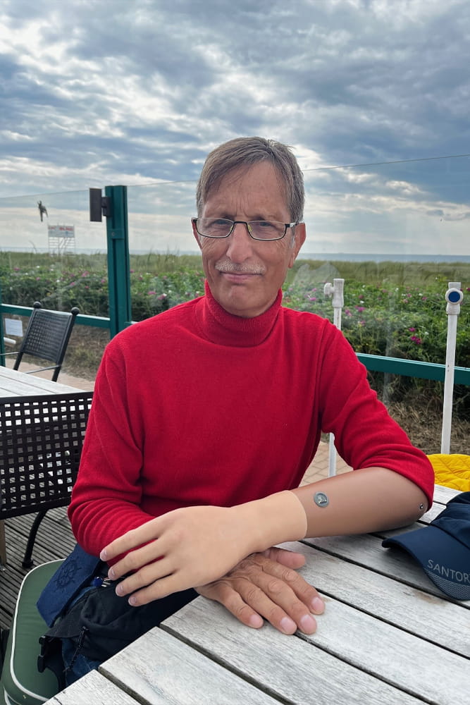Christian Wolschon mit seinem Prothesenarm.