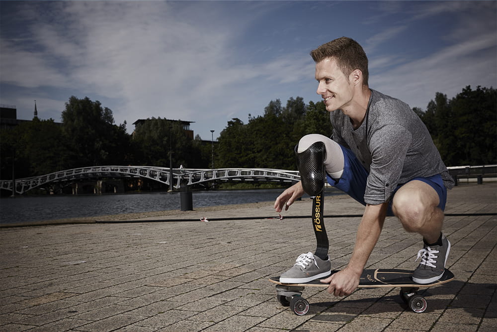 Ein Mann mit Beinprothese fährt auf seinem Skateboard.