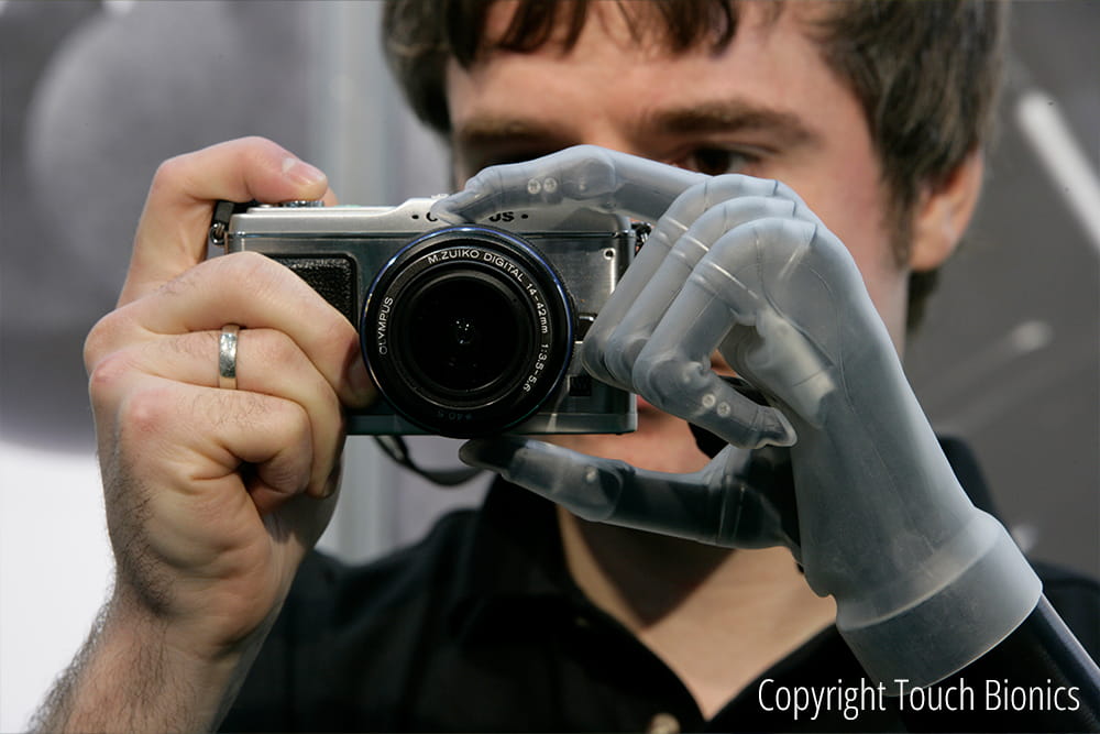 Ein Mann mit Bionischer Hand hält eine Digitalkamera in der Hand.
